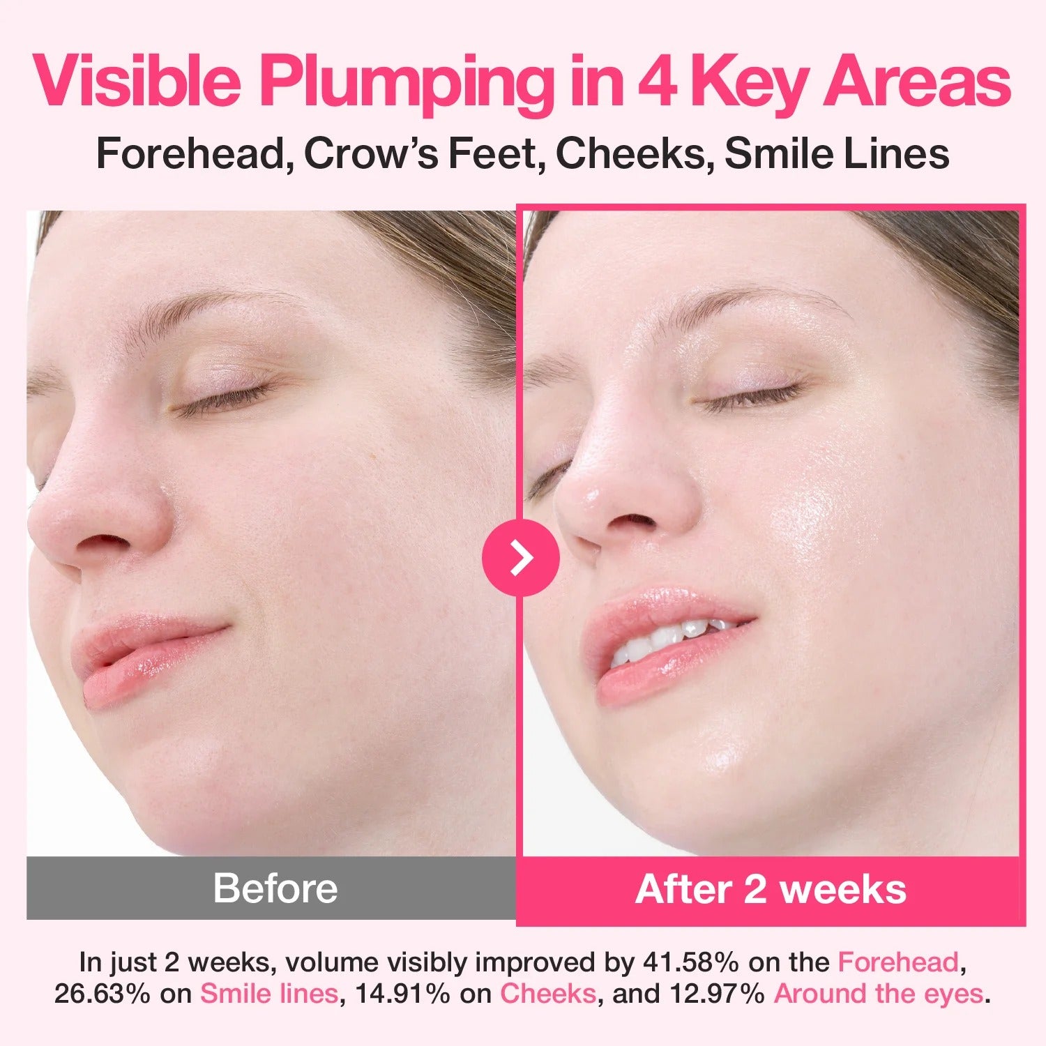 No. 2 Rose PDRN Collagen Plumping Serum (30ml)