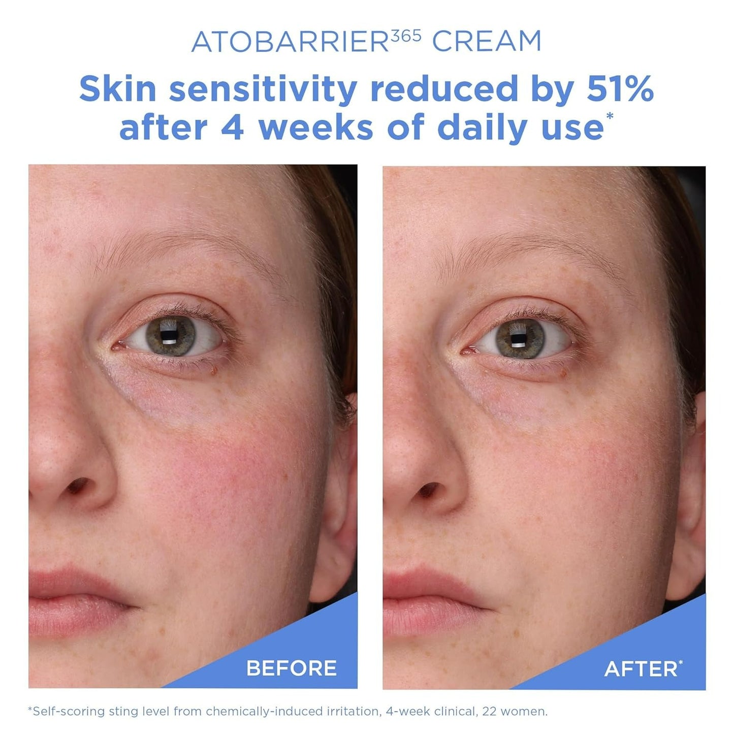 AtoBarrier 365 Cream (80ml)