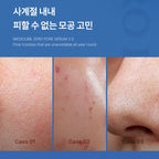 Zero Pore Serum 2.0 (37ml)