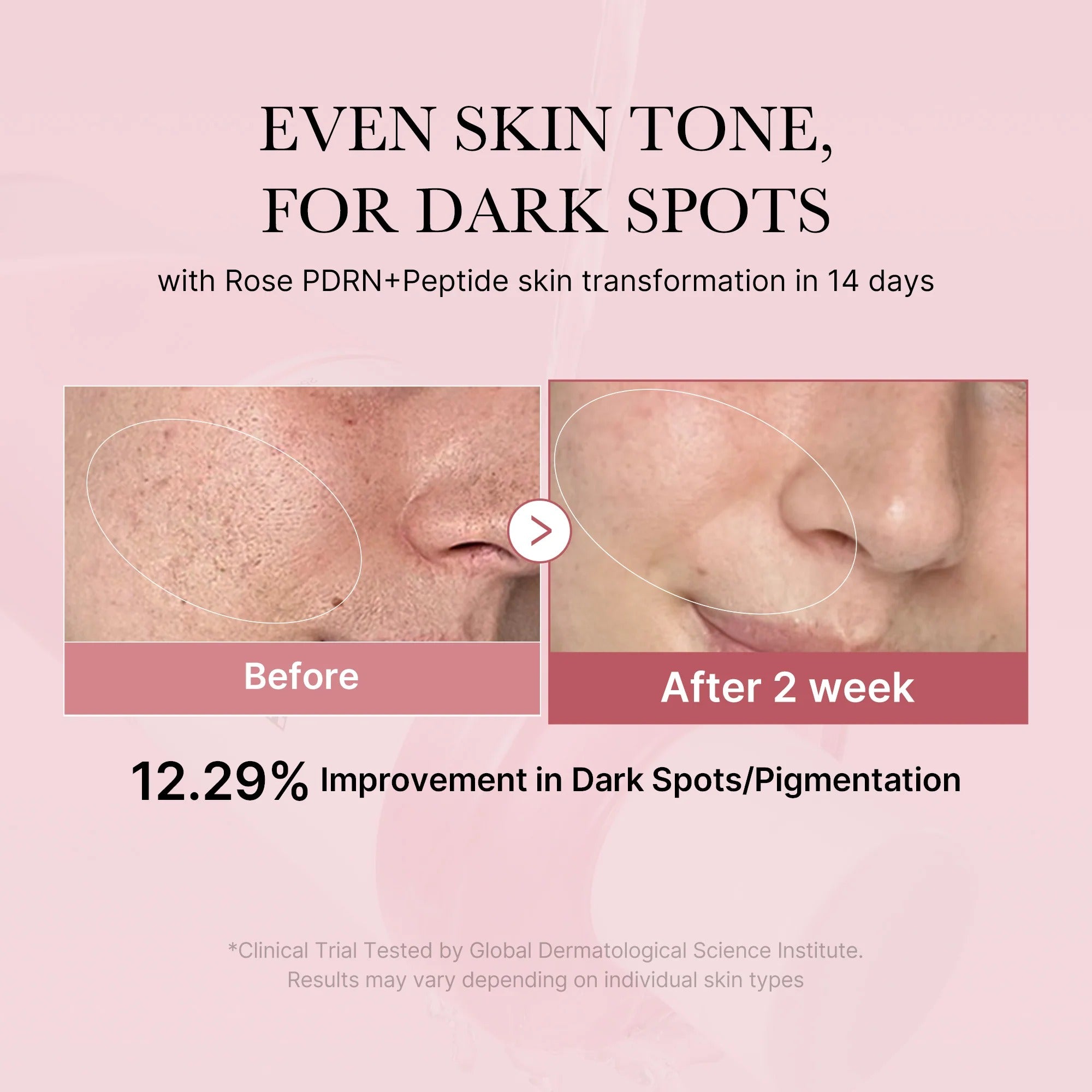 PDRN Pink Cica Soothing Toner (250ml)