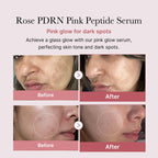 PDRN Pink Peptide Serum (30ml)