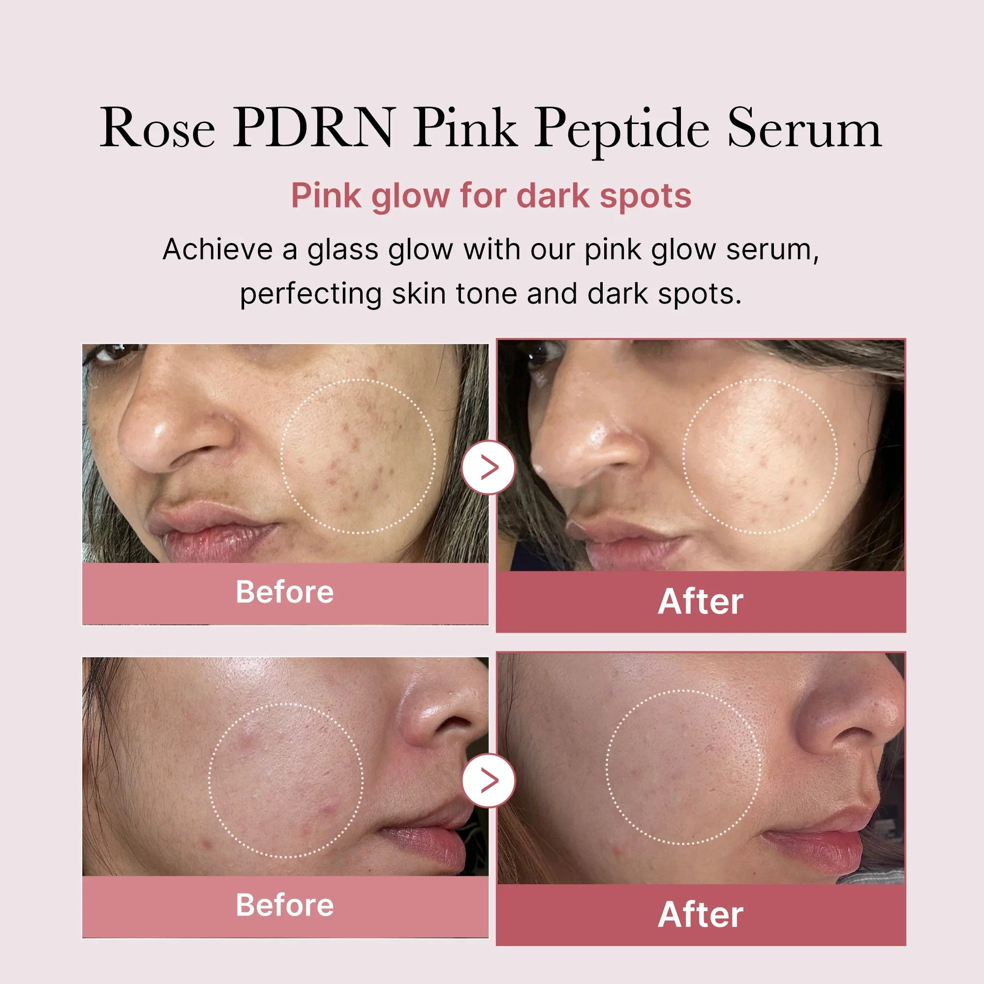 PDRN Pink Peptide Serum (30ml)