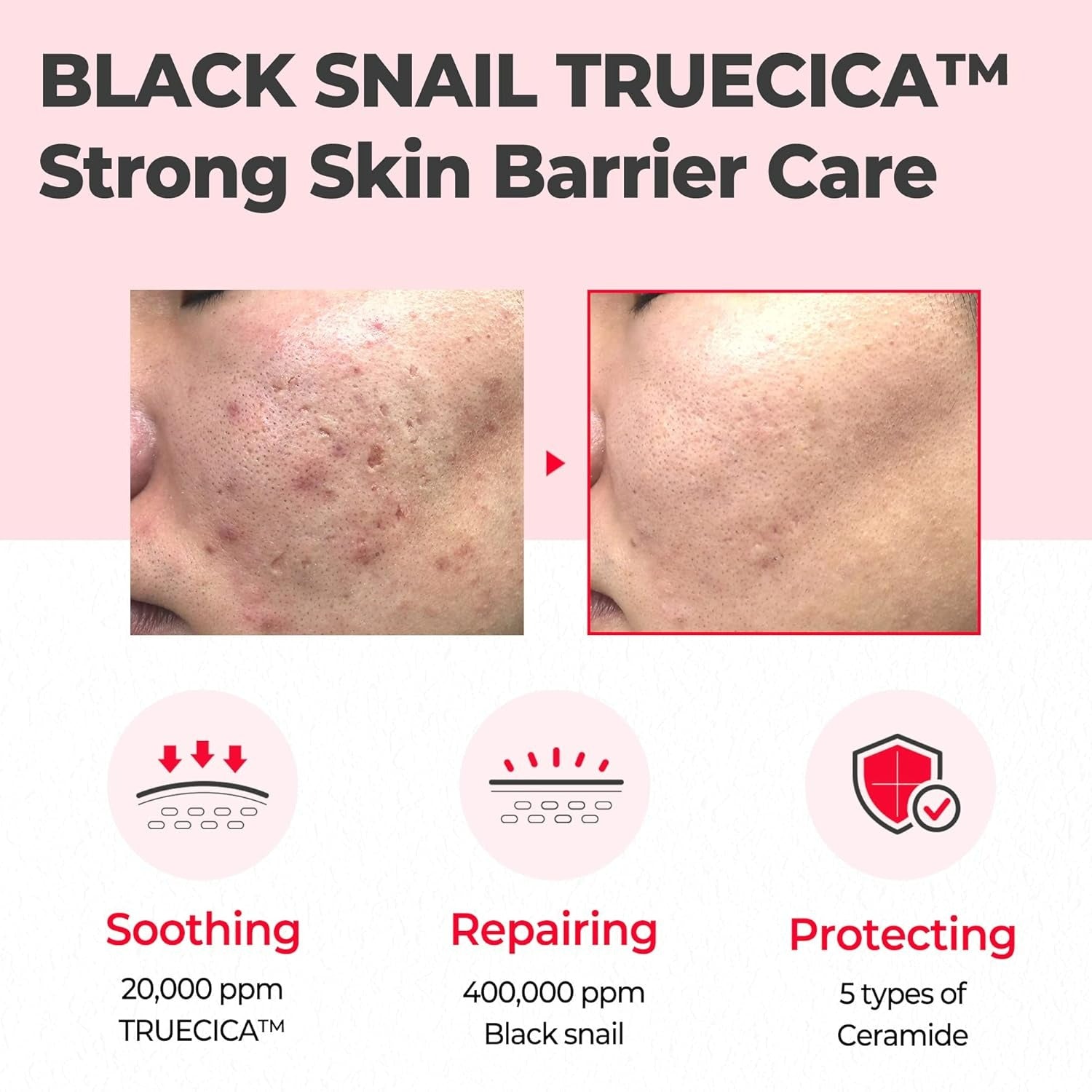 Snail Truecica Miracle Repair Cream (60g)
