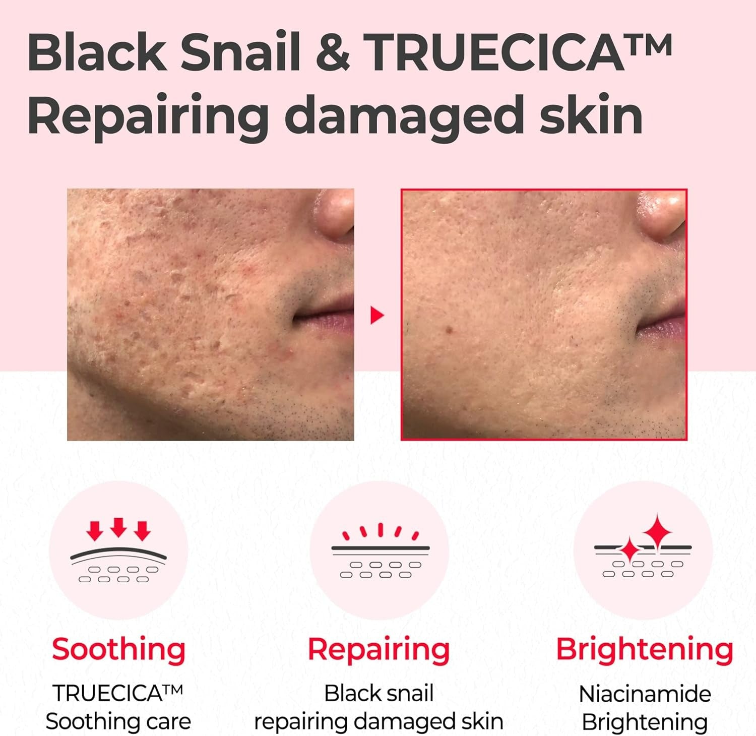 Snail Truecica Miracle Repair Toner (150ml)