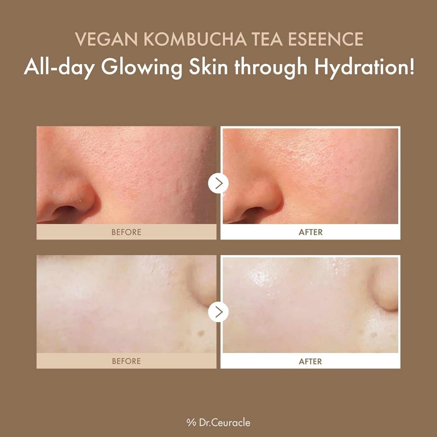 Vegan Kombucha Tea Essence (150ml)