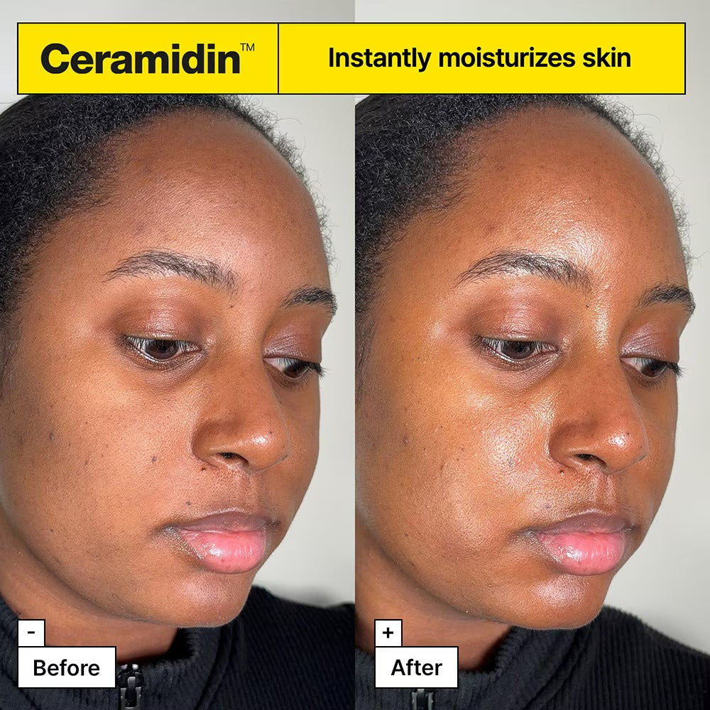 Ceramidin™ Skin Barrier Moisturizing Cream (50ml)