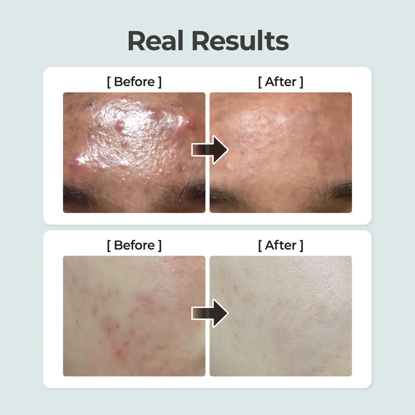 No. 1 Pure-Full Calming Herb Toner (300ml)