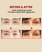 SEOUL 1988 Eye Cream : Retinal Liposome 4% + Fermented Bean (30ml)