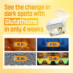 No. 5 Vitamin Glutathione Dark Spot Laser Cream (50ml)