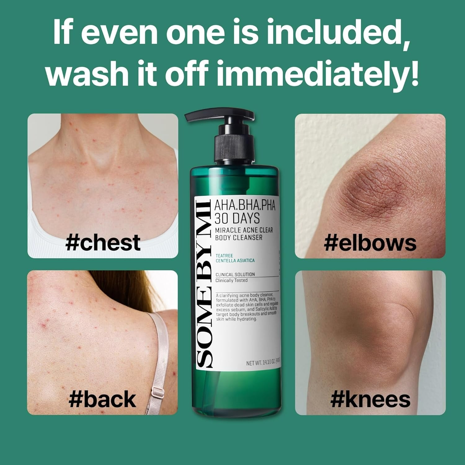 AHA, BHA, PHA 30 Days Miracle Acne Clear Body Cleanser (400g)