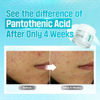 No. 1 Pantothenic B5 Active Soothing Cream (50ml)