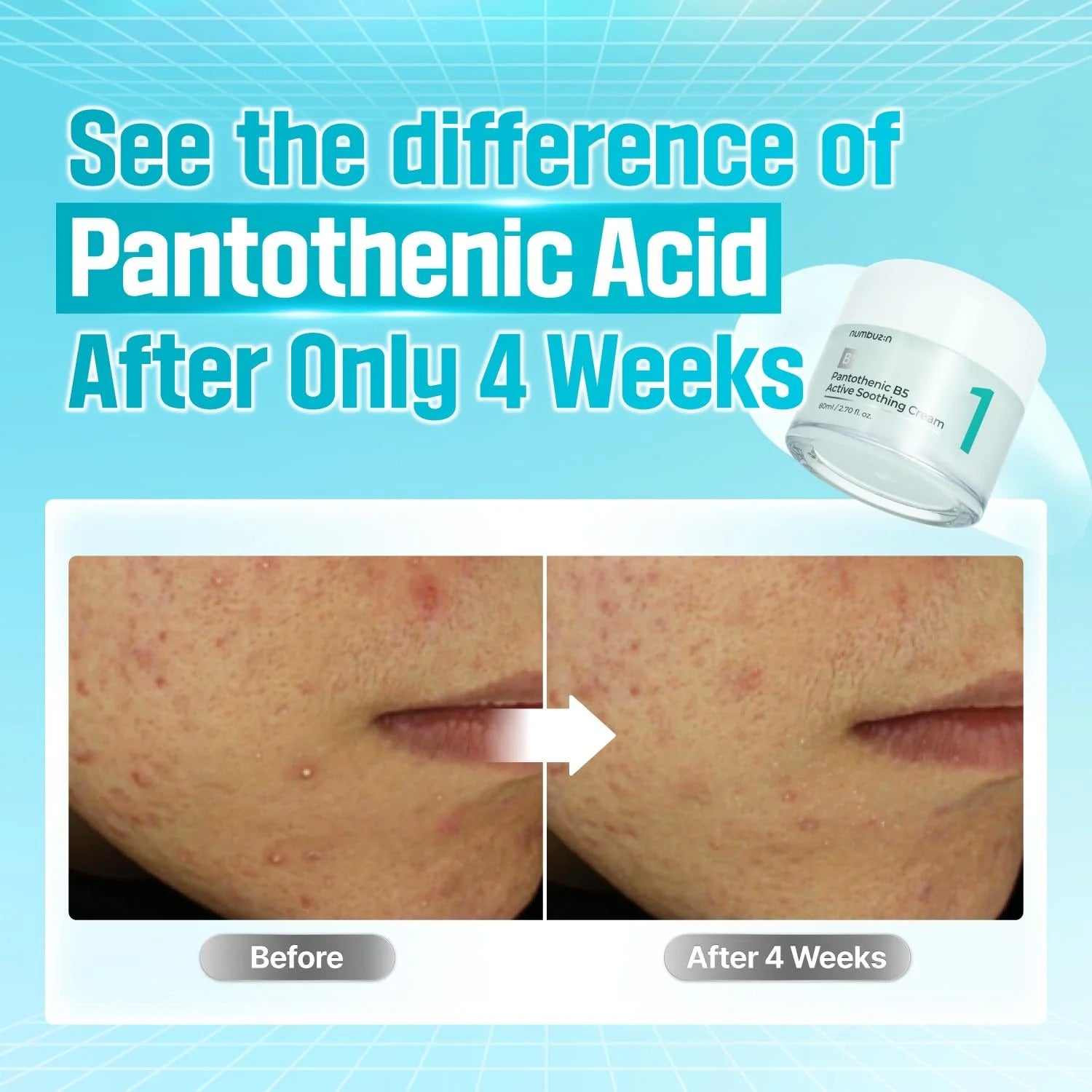 No. 1 Pantothenic B5 Active Soothing Cream (50ml)