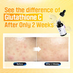 No. 5+ Glutathione Vitamin Concentrated Serum (30ml)