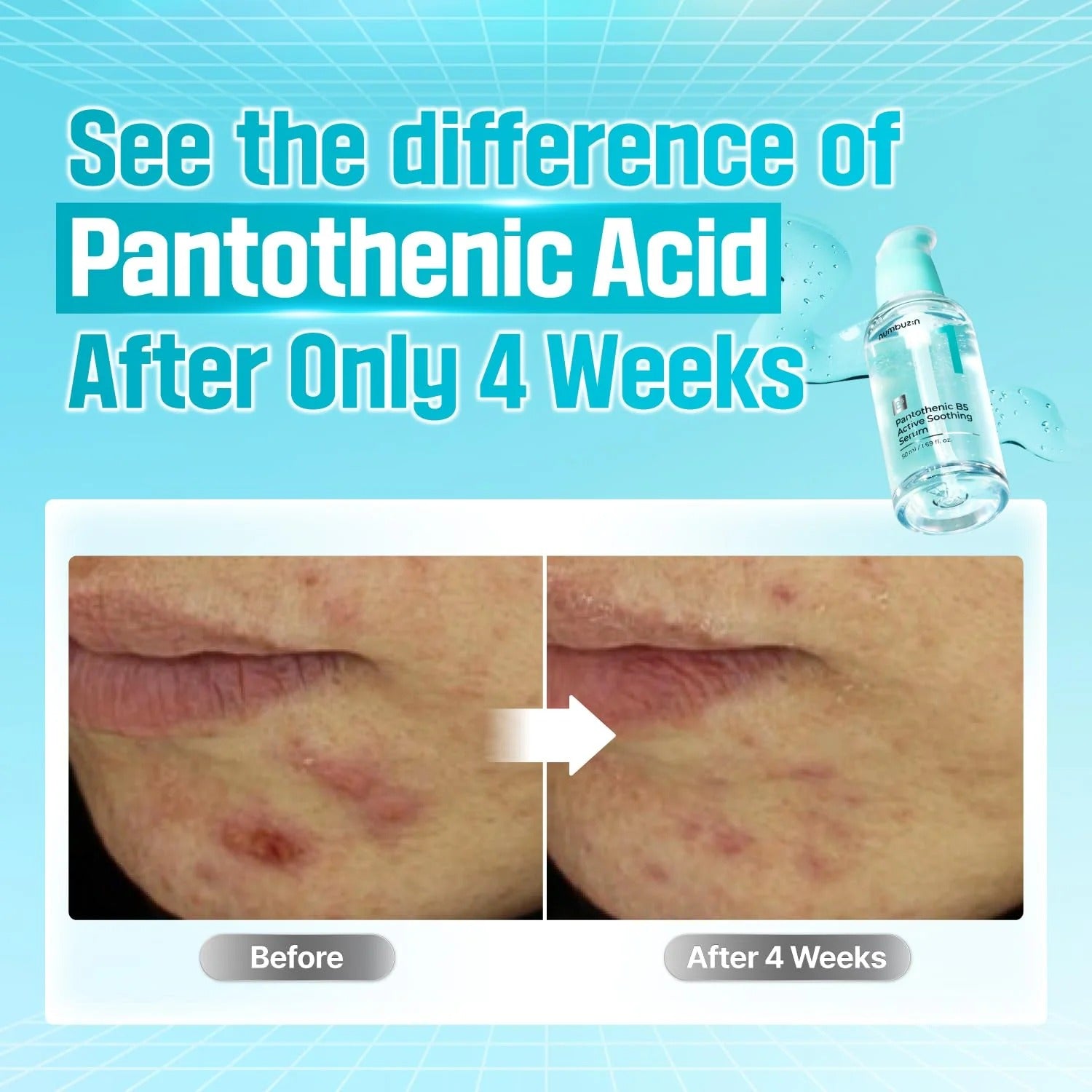 No. 1 Pantothenic B5 Active Soothing Serum (50ml)