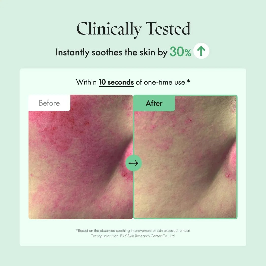 Wonder Releaf Centella Eye Cream Unscented (30ml)