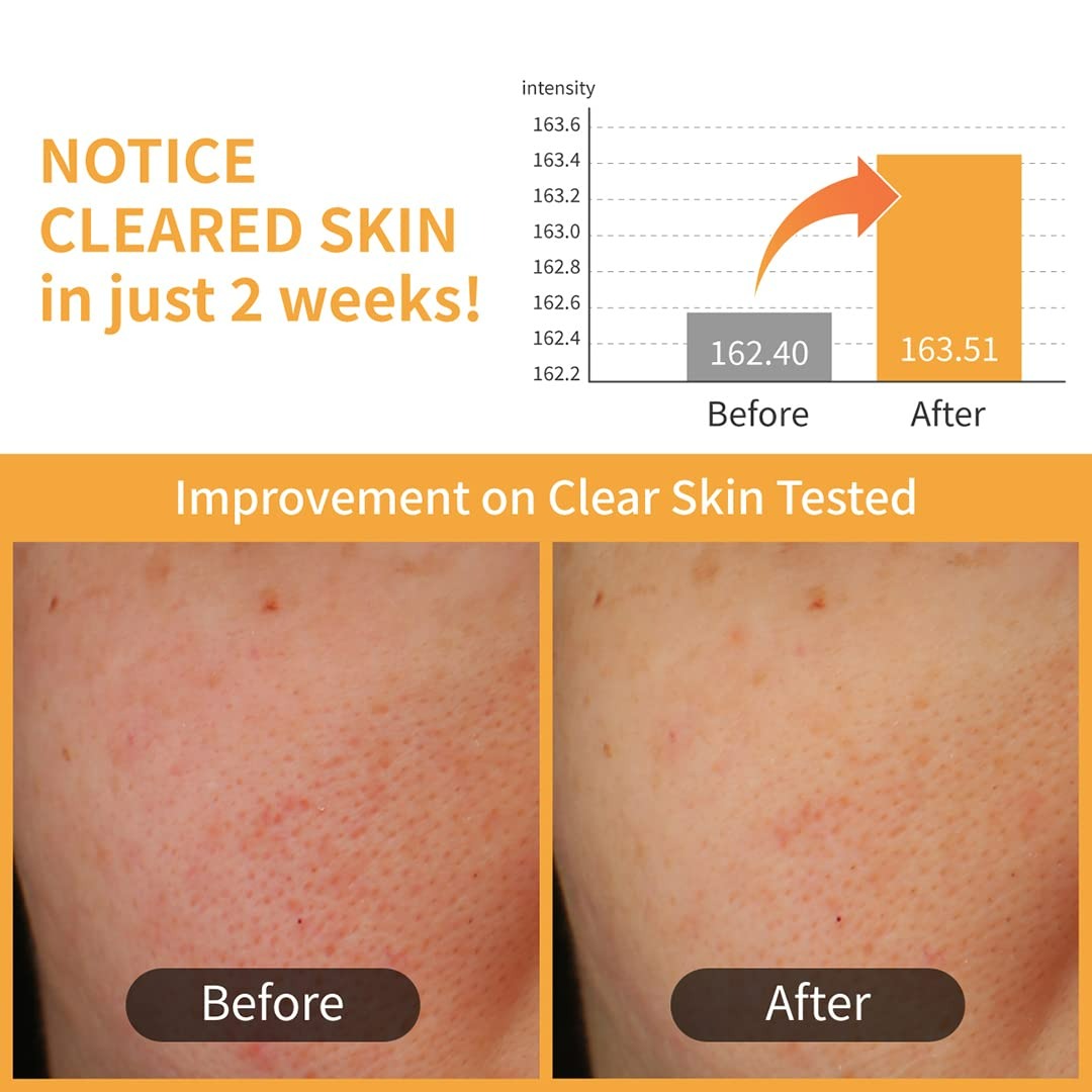 No. 3 Radiance Glowing Jumbo Essence Pad (70pads)