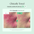 Wonder Releaf Centella Serum Unscented (60ml)