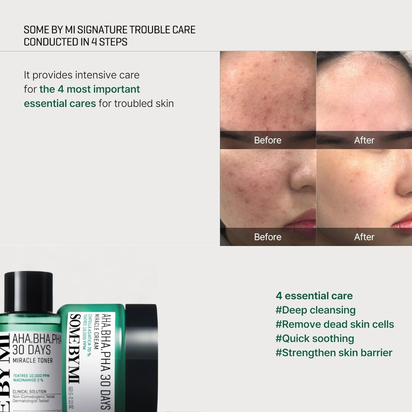 AHA BHA PHA 30 Days Miracle Starter Kit (4pcs)