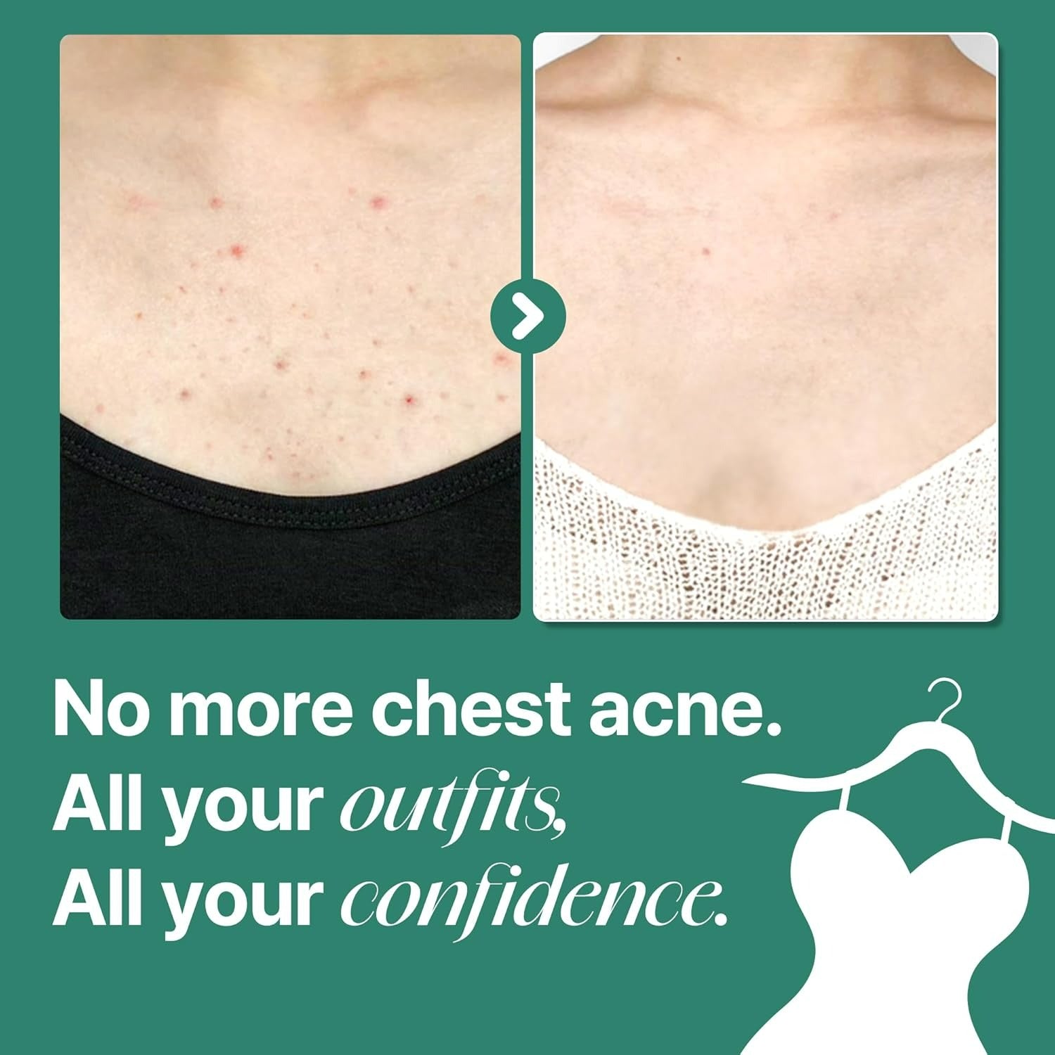 AHA, BHA, PHA 30 Days Miracle Acne Clear Body Cleanser (400g)
