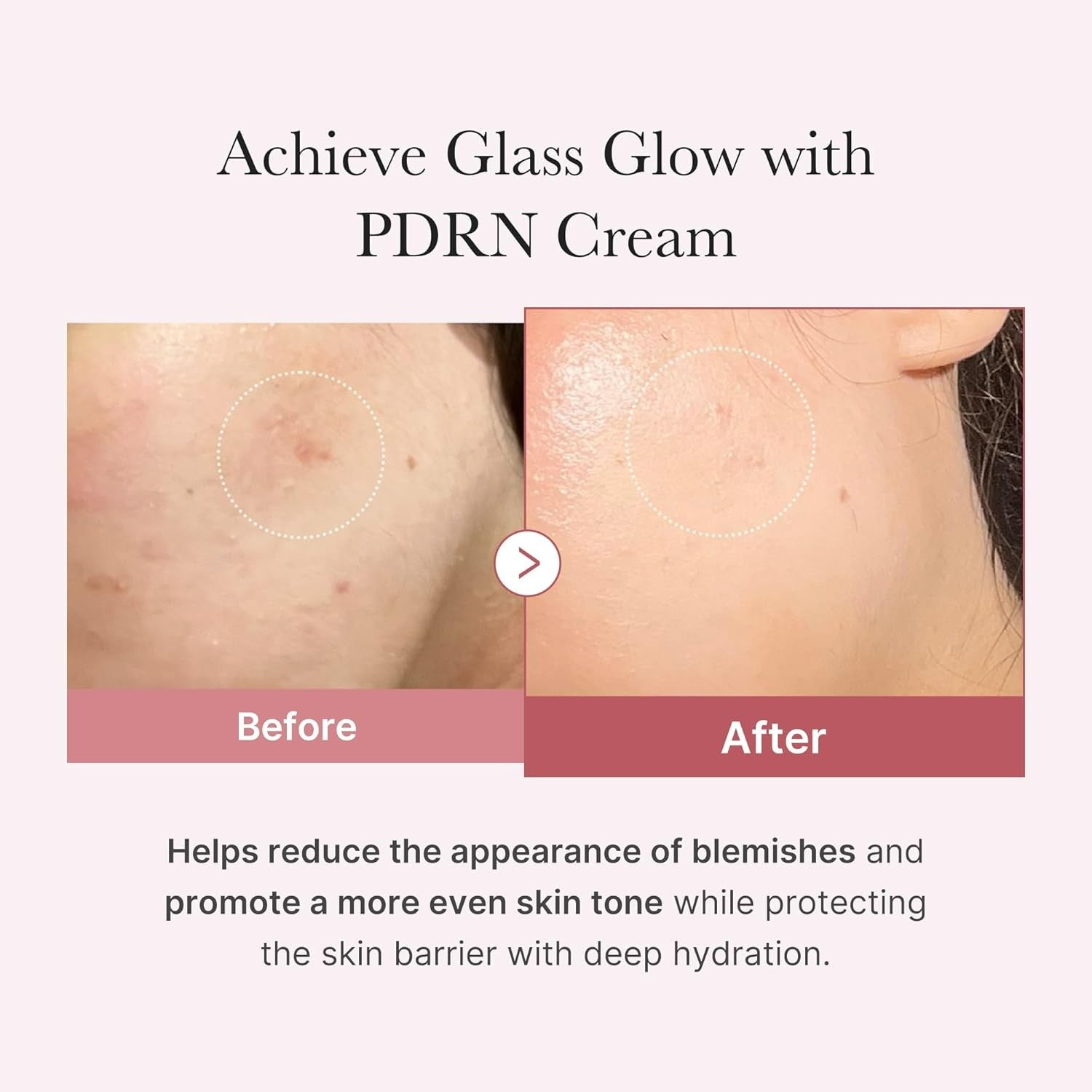 PDRN Pink Hyaluronic Moisturizing Cream (50ml)