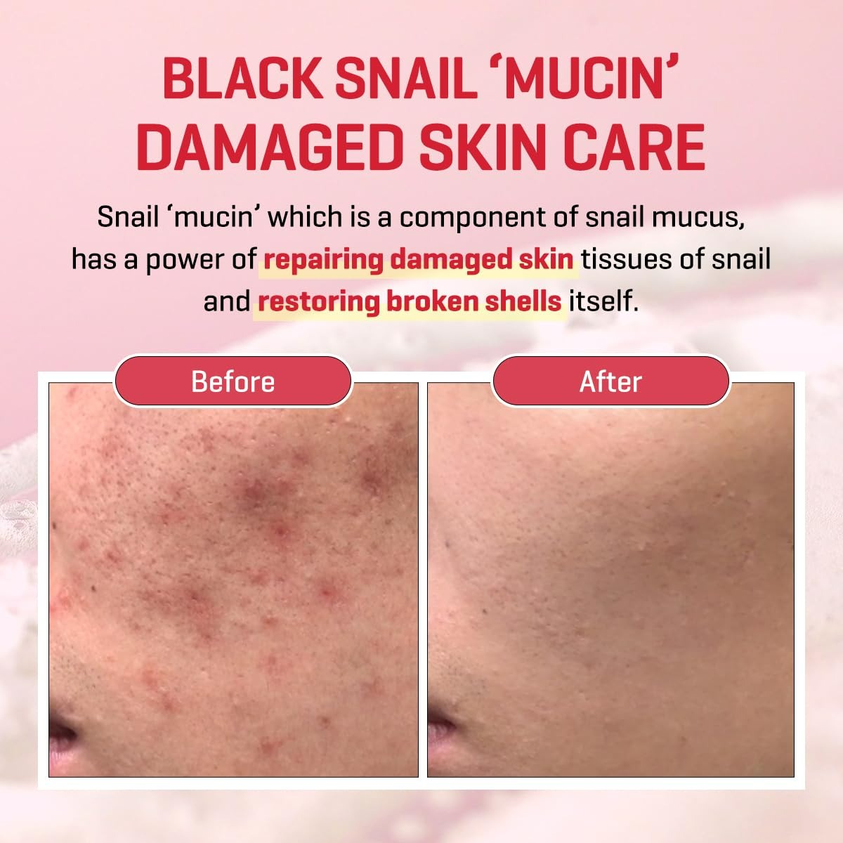 Snail Truecica Miracle Repair Low pH Gel Cleanser (100ml)