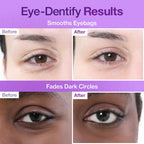 No. 9 NAD+ Collagen Under Eye Patches (8g*5pairs)