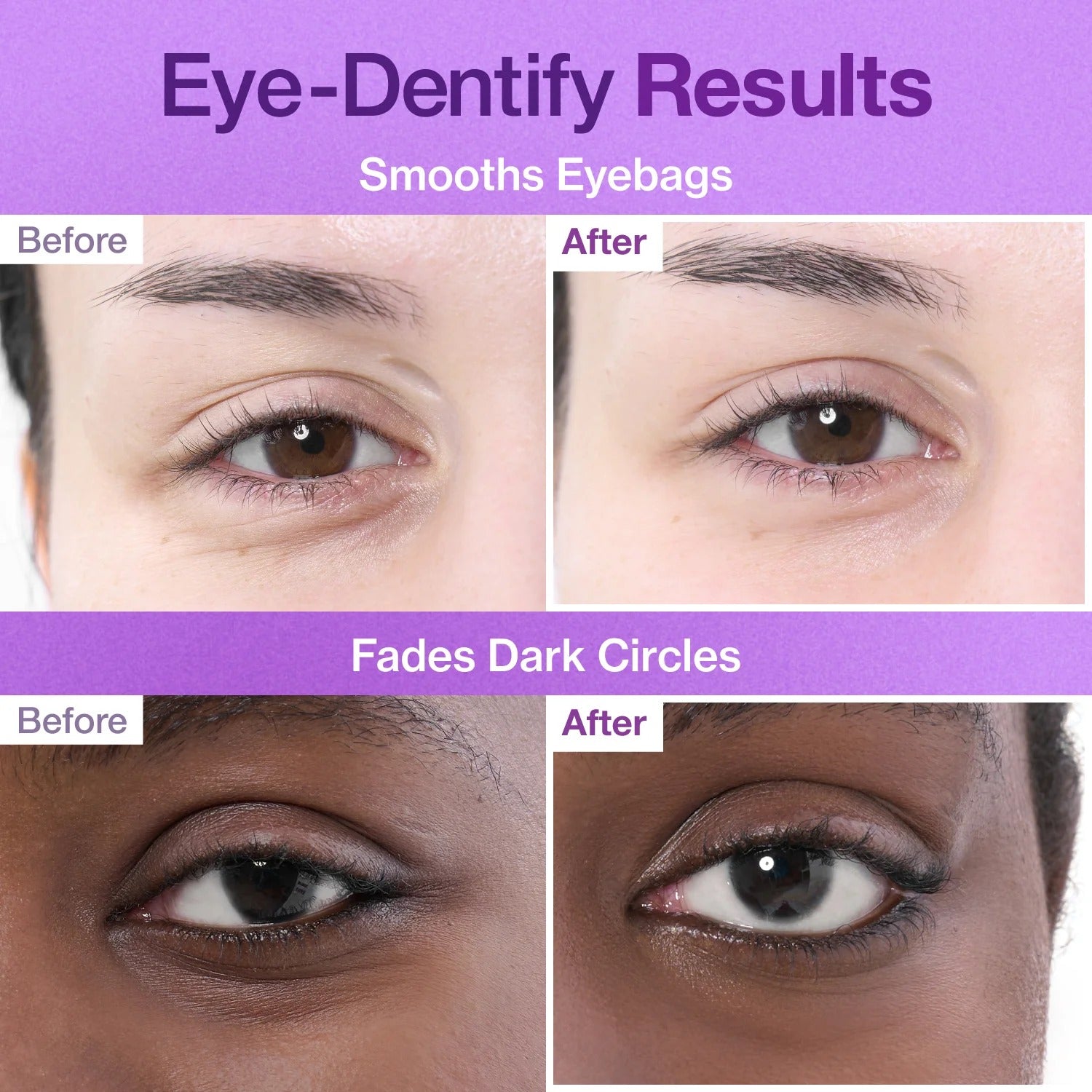 No. 9 NAD+ Collagen Under Eye Patches (8g*5pairs)