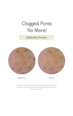 Deep Pore Cleansing Soda Foam