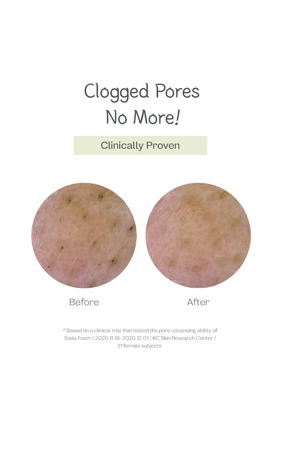Deep Pore Cleansing Soda Foam