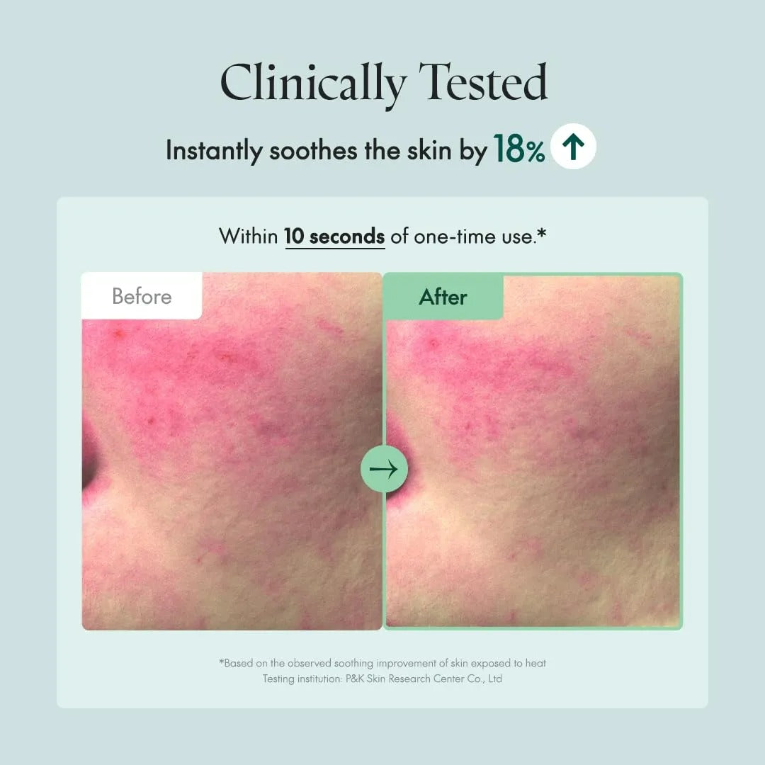 Wonder Releaf Centella Serum (60ml)