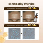 Galactomyces Pure Vitamin C Glow Serum (30ml)
