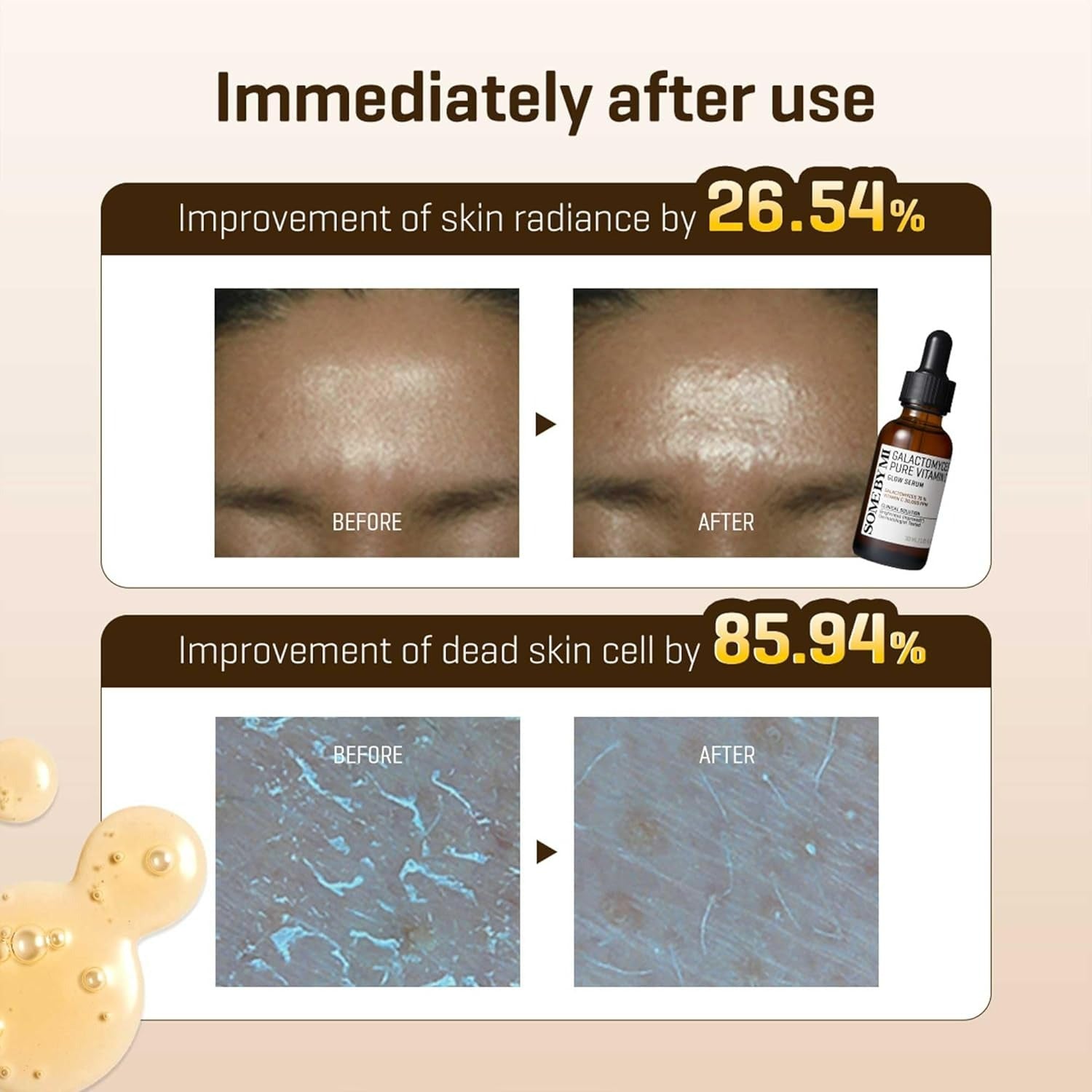 Galactomyces Pure Vitamin C Glow Serum (30ml)