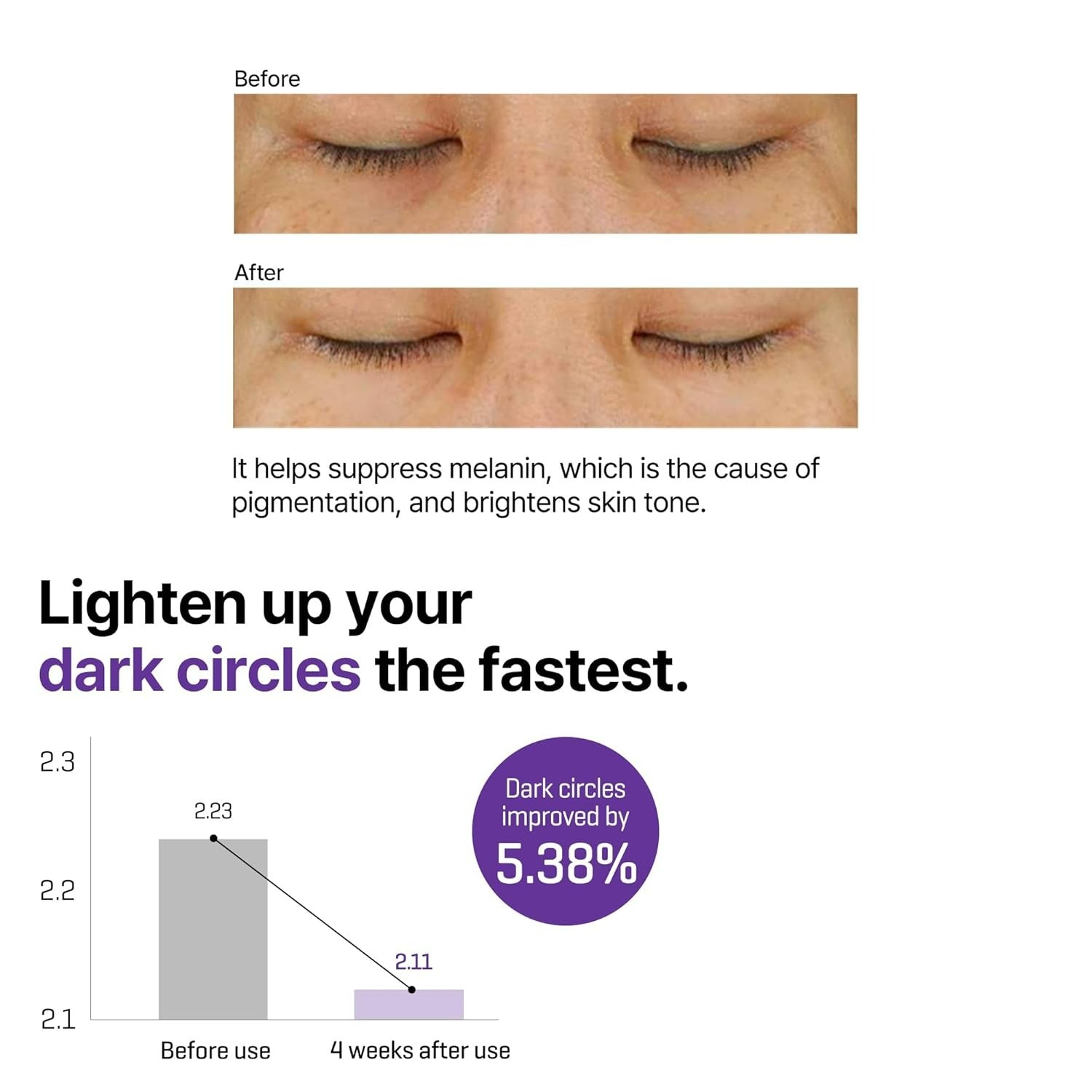 Retinol Intense Advanced Triple Action Eye Cream (30ml)