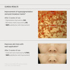 Yuja Niacin Anti Blemish Cream (60g)