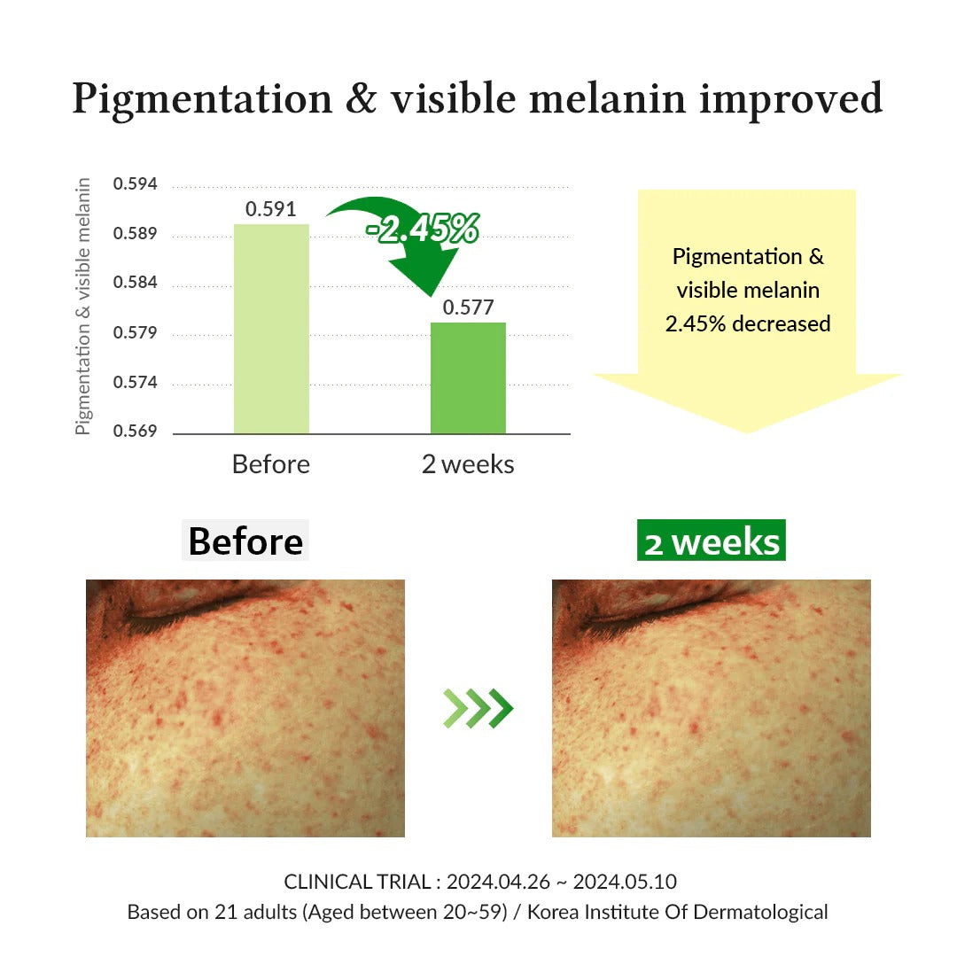 Gentle Vitamin C Serum (30ml)