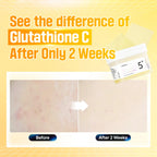 No. 5+ Glutathione Vitamin-Niacinamide Concentrated Pad (70pads)
