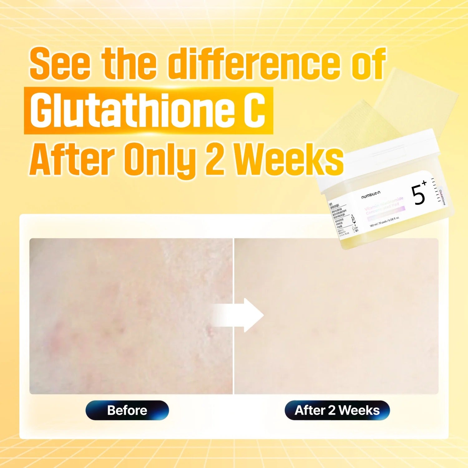 No. 5+ Glutathione Vitamin-Niacinamide Concentrated Pad (70pads)