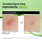 Azelaic Acid 10 Hyaluron Redness Soothing Serum (30ml)