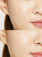 Acne Pimple Master Patch (1sheet)