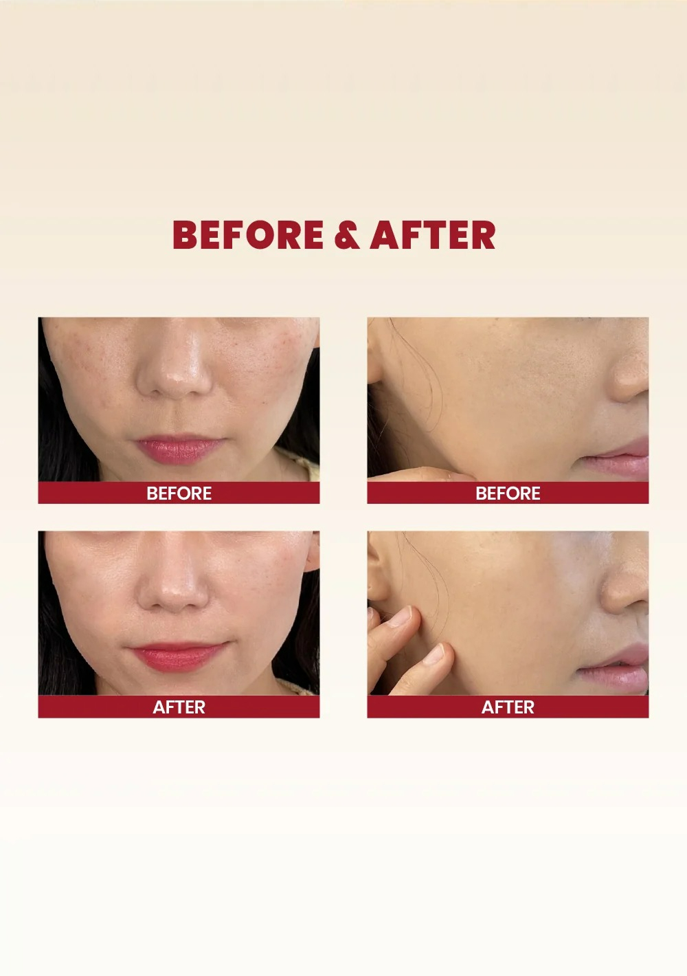 SEOUL 1988 Essence : Snail Mucin 97% + Rice (100ml)