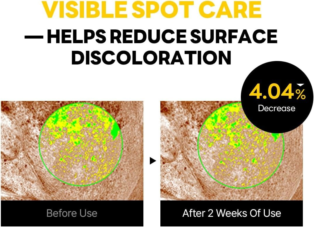 Vita Niacinamide Dark Spot Cream (50ml)