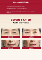 SEOUL 1988 Cream : Retinal Liposome 1% + Fermented Rice (50ml)