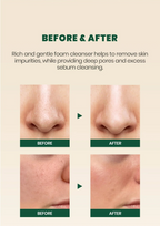 SEOUL 1988 Cleansing Foam : Pine Cica 1% + Probiotics (150ml)