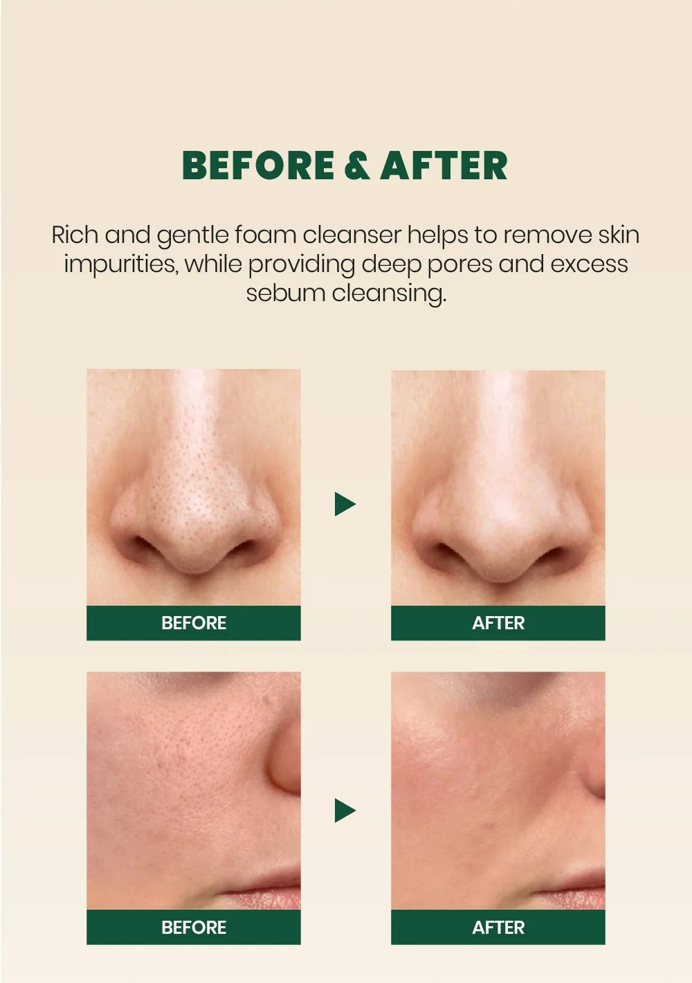 SEOUL 1988 Cleansing Foam : Pine Cica 1% + Probiotics (150ml)