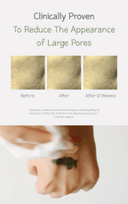 Deep Pore Cleansing Soda Foam