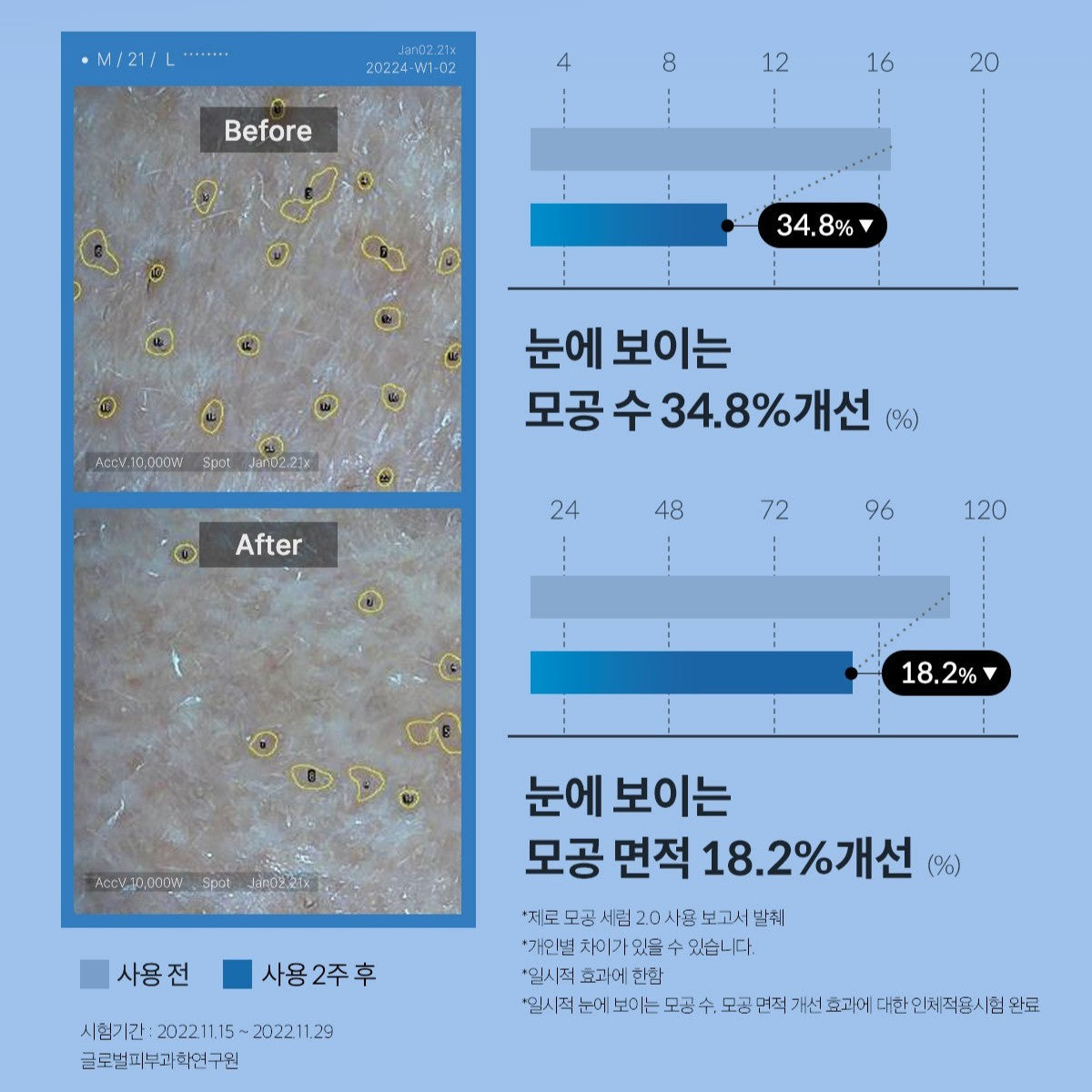 Zero Pore Serum 2.0 (37ml)