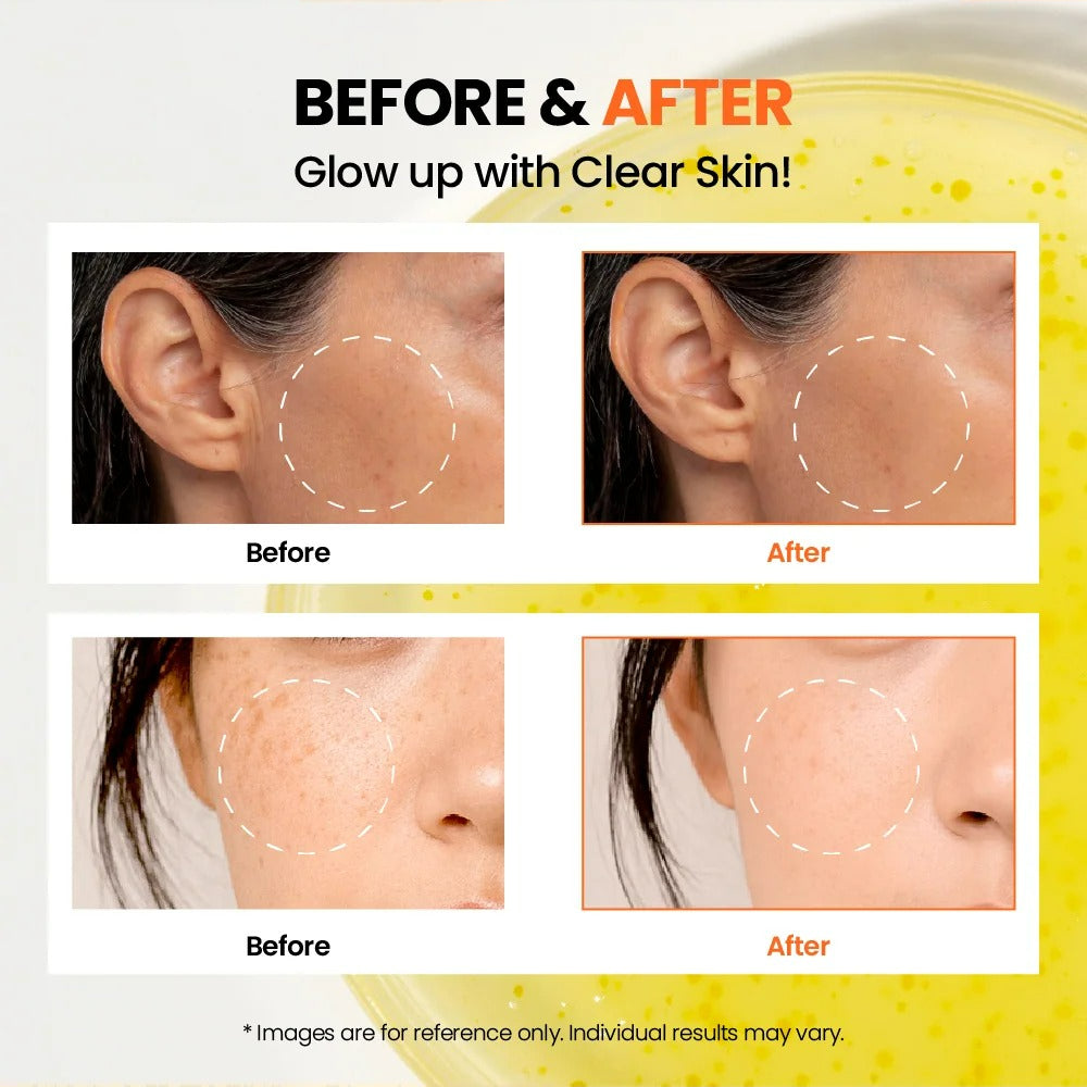 SEOUL 1988 Glow Serum : Niacinamide 15% + Yuja (30ml)