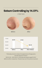 Blackhead & Pore Toner