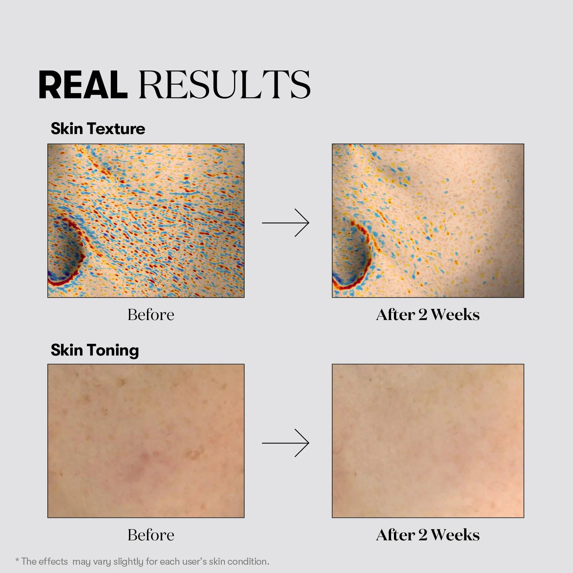 TX-toning Daily Mask (30 sheets)