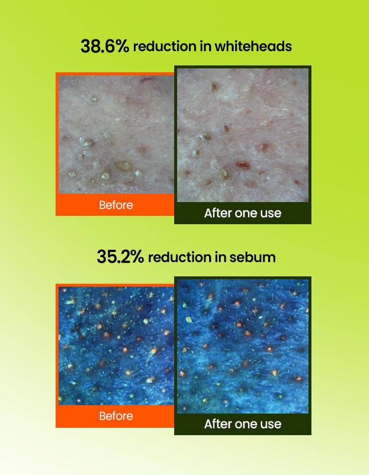 Mung Bean Pore Grinding Cleansing Balm (100ml)